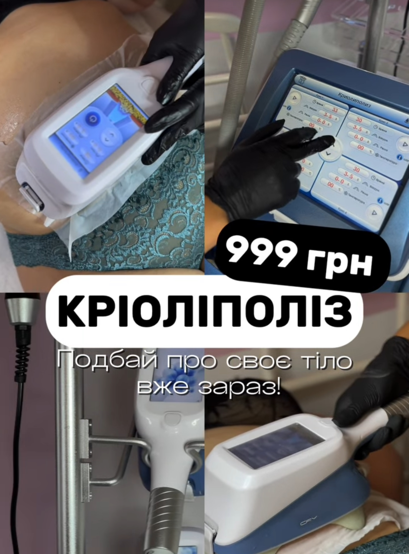 Запис на епіляцію Чернігів