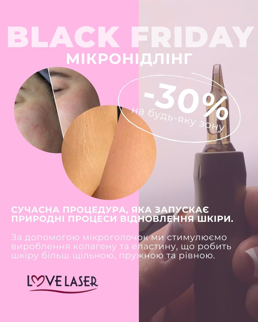 Запис на епіляцію Чернігів